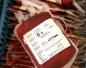 Beni : l’absence des matériels d’analyse du sang à la base de l’arrêt du don de sang dans la zone de santé de Mutwanga