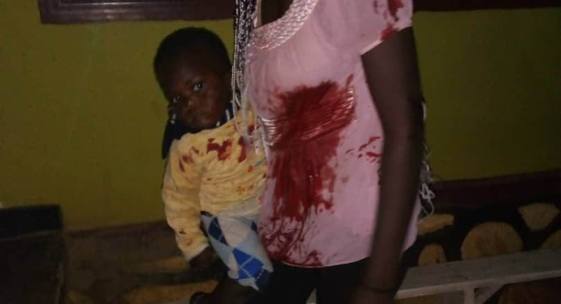 Beni : des personnes blessées au marché de Macampagne